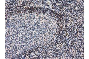 Image no. 3 for anti-Nonhomologous End-Joining Factor 1 (NHEJ1) antibody (ABIN1499729) (NHEJ1 抗体)