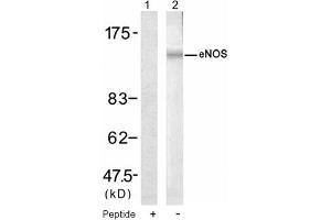 Image no. 1 for anti-Nitric Oxide Synthase 3 (Endothelial Cell) (NOS3) (Ser1177) antibody (ABIN319319) (ENOS 抗体  (Ser1177))