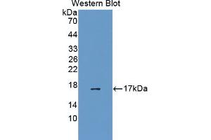 Western blot analysis of the recombinant protein. (EEA1 抗体  (AA 1232-1348))