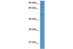 WB Suggested Anti-St6gal2 Antibody Titration: 1. (ST6GAL2 抗体  (C-Term))