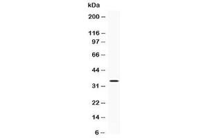 Western blot testing of human A431 cell lysate with NAT1 antibody at 0. (NAT1 抗体  (AA 172-201))