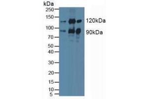 Western blot analysis of (1) Human HeLa cells, (2) Mouse Brain Tissue and (3) Porcine Brain Tissue. (PKC epsilon 抗体  (AA 403-672))