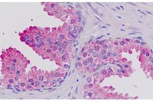 Human Prostate: Formalin-Fixed, Paraffin-Embedded (FFPE) (AF4 抗体  (AA 1181-1210))