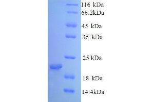 SDS-PAGE (SDS) image for Caveolin 1, Caveolae Protein, 22kDa (CAV1) (AA 1-178) protein (His tag) (ABIN7478928)