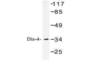 Western blot (WB) analysis of Dlx-4 antibody in extracts from COLO cells. (DLX4 抗体)