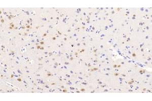 Detection of NOVA1 in Human Cerebrum Tissue using Polyclonal Antibody to Neuro Oncological Ventral Antigen 1 (NOVA1) (NOVA1 抗体  (AA 295-510))
