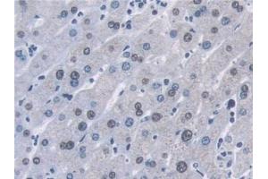 Detection of AHNAK in Human Liver Tissue using Polyclonal Antibody to Desmoyokin (AHNAK) (AHNAK 抗体  (AA 1-300))
