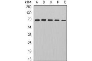 Western blot analysis of PDC-E2 expression in HepG2 (A), Jurkat (B), mouse heart (C), rat brain (D), rat kidney (E) whole cell lysates. (DLAT 抗体)