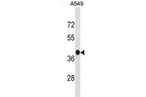Western Blotting (WB) image for anti-G Protein-Coupled Receptor 77 (GPR77) antibody (ABIN3001276) (GPR77 抗体)
