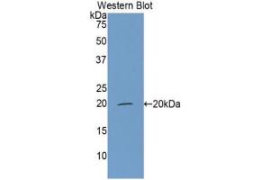 Western blot analysis of the recombinant protein. (CFP 抗体  (AA 315-469))