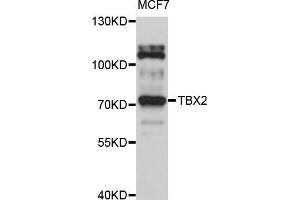 Western blot analysis of extracts of MCF-7 cells, using TBX2 antibody (ABIN5999016) at 1/1000 dilution. (TBX2 抗体)