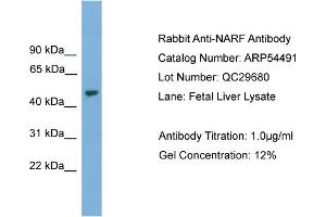 WB Suggested Anti-NARF  Antibody Titration: 0. (NARF 抗体  (Middle Region))