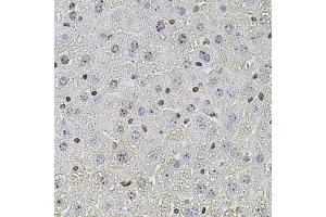 Immunohistochemistry of paraffin-embedded mouse liver using POT1 antibody (ABIN5970699) at dilution of 1/100 (40x lens). (POT1 抗体)