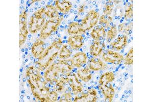 Immunohistochemistry of paraffin-embedded Mouse kidney using EEA1 Polyclonal Antibody at dilution of 1:100 (40x lens). (EEA1 抗体)