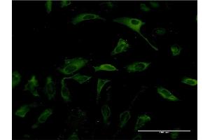 Immunofluorescence of monoclonal antibody to PKLR on HeLa cell. (PKLR 抗体  (AA 485-574))