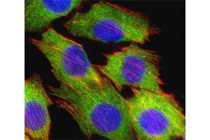 Fluorescent confocal image of C2C12 cell stained with AKT2 antibody at 1:25.