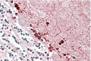 AP20186PU-N ALDH9A1 antibody staining of paraffin embedded Human Cerebellum at 3. (ALDH9A1 抗体  (Internal Region))