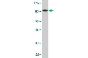 Western Blotting (WB) image for anti-Proteasome (Prosome, Macropain) 26S Subunit, Non-ATPase, 5 (PSMD5) (AA 1-504) antibody (ABIN519401)