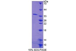 SDS-PAGE analysis of Human CES1 Protein. (CES1 蛋白)