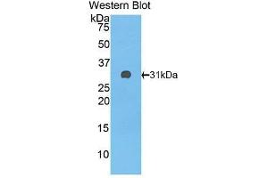Western Blotting (WB) image for anti-Complement Factor H (CFH) (AA 915-1156) antibody (ABIN3208199) (Complement Factor H 抗体  (AA 915-1156))