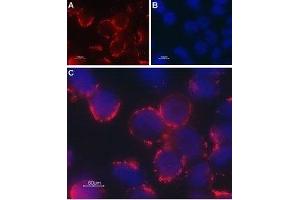 Expression of TRPC6 in rat PC12 cells - Cell surface detection of TRPC6 in intact living PC12 cells.