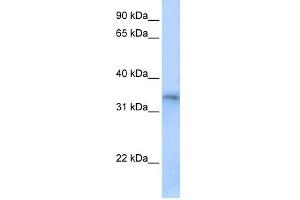WB Suggested Anti-FHL5 Antibody Titration:  0. (FHL5 抗体  (Middle Region))