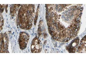 Immunohistochemistry (IHC) image for anti-ATPase, H+/K+ Transporting, Nongastric, alpha Polypeptide (ATP12A) (N-Term) antibody (ABIN6256922)