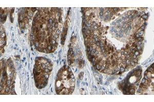 ABIN6273377 at 1/100 staining Human prostate tissue by IHC-P. (ATP12A 抗体  (N-Term))