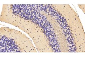 Detection of NME1 in Mouse Cerebellum Tissue using Polyclonal Antibody to Non Metastatic Cells 1, Protein NM23A Expressed In (NME1) (NME1 抗体  (AA 6-147))