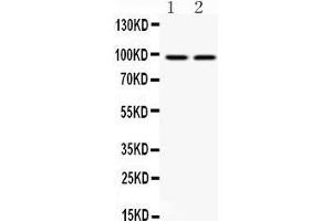 Anti- AHR Picoband antibody, Western blotting All lanes: Anti AHR  at 0. (Aryl Hydrocarbon Receptor 抗体  (Middle Region))