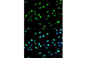 Immunofluorescence analysis of MCF7 cell using LETMD1 antibody. (LETMD1 抗体  (AA 161-360))