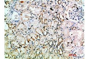 Immunohistochemical analysis of paraffin-embedded human-kidney, antibody was diluted at 1:200 (L1CAM 抗体  (AA 151-200))