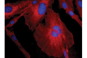 Human astrocytoma cell line CCF-STTG1 was stained with Mouse Anti-Human GFAP-CY3 and DAPI. (GFAP 抗体  (Biotin))