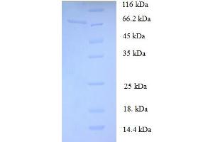 SDS-PAGE (SDS) image for Sensitivity To Stroke QTL 3 (STRS3) (AA 1-465), (full length) protein (His-SUMO Tag) (ABIN5710952)