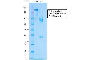 SDS-PAGE Analysis of Purified MART-1 Rabbit Recombinant Monoclonal Antibody (MLANA/1409R). (Recombinant MLANA 抗体)
