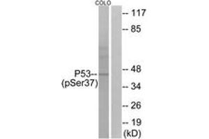 Western blot analysis of extracts from COLO cells, using p53 (Phospho-Ser37) Antibody.