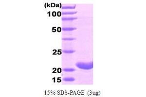 SDS-PAGE (SDS) image for Ferritin, Heavy Polypeptide 1 (FTH1) (AA 1-183) protein (ABIN667083)
