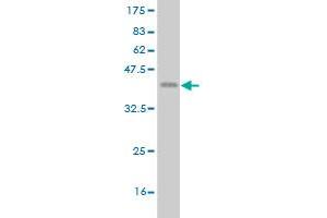 Western Blot detection against Immunogen (37. (ETV1 抗体  (AA 148-257))