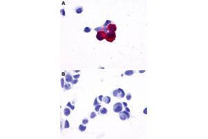 Immunocytochemistry (ICC) staining of HEK293 human embryonic kidney cells transfected (A) or untransfected (B) with PRLHR. (PRLHR 抗体  (2nd Extracellular Domain))