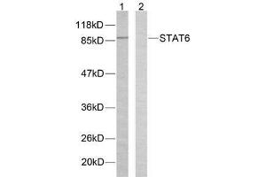Western blot analysis of extracts from HeLa cells using STAT6 (Ab-645) antibody (E021051). (STAT6 抗体)