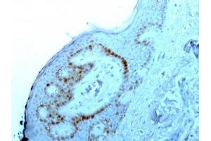 Image no. 1 for anti-Nucleolar / Nucleoli antibody (ABIN6153718) (Nucleolar / Nucleoli 抗体)