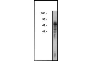 Image no. 1 for anti-Collagen, Type IV, alpha 3 (Goodpasture Antigen) Binding Protein (COL4A3BP) antibody (ABIN793680) (COL4A3BP 抗体)