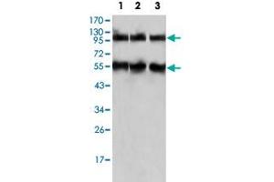Western blot analysis using PEG10 monoclonal antobody, clone 4C10A7  against HepG2 (1), SMMC-7721 (2) and A-549 (3) cell lysate.
