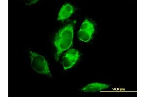 Immunofluorescence of purified MaxPab antibody to MRPL1 on HeLa cell. (MRPL1 抗体  (AA 1-303))