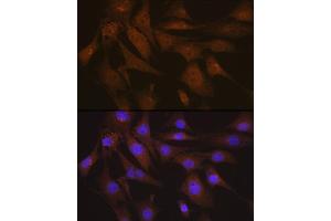 Immunofluorescence analysis of NIH-3T3 cells using LIS1 Rabbit mAb (ABIN7269401) at dilution of 1:100 (40x lens). (PAFAH1B1 抗体)