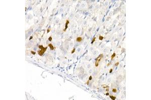 Immunohistochemistry (IHC) image for anti-Dopa Decarboxylase (Aromatic L-Amino Acid Decarboxylase) (DDC) (AA 1-100) antibody (ABIN1679510)