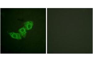 Immunofluorescence analysis of HuvEc cells, using EGFR (Phospho-Thr678) Antibody. (EGFR 抗体  (pThr678))