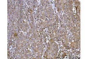 IHC analysis of CCDC115 using anti-CCDC115 antibody (ABIN7599042).