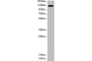 Western blot All lanes: USP28 antibody at 3. (USP28 抗体  (AA 430-580))
