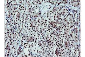 Image no. 2 for anti-Tumor Protein P73 (TP73) (AA 167-409) antibody (ABIN1491005) (Tumor Protein p73 抗体  (AA 167-409))